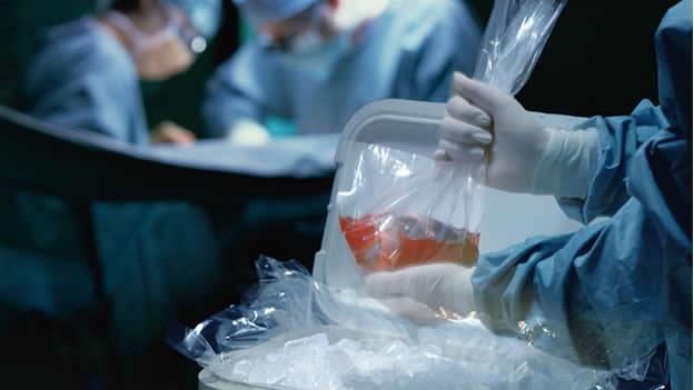 Dicen hay limitantes para donar órganos